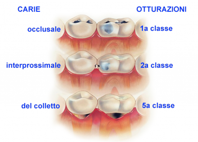 Odontoiatria conservativa Torino